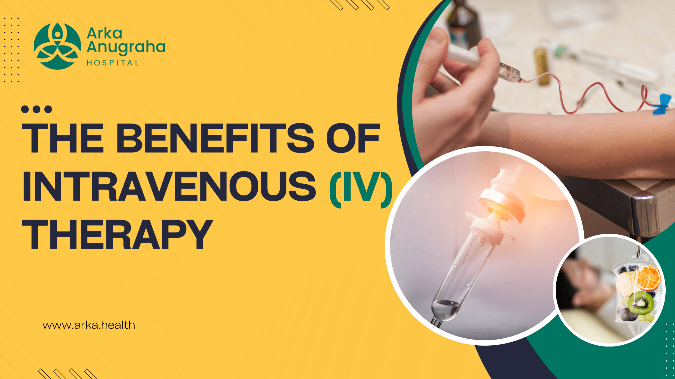 Vitamin C IV Therapy in Cancer Mechanisms and Evidence