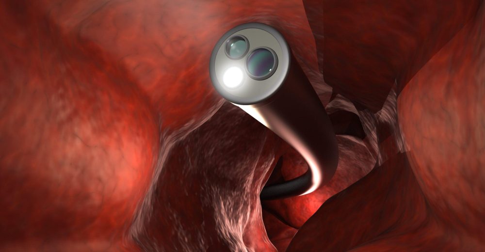 colonoscopy-technology-concept-with-endoscope-inside-intestine-min